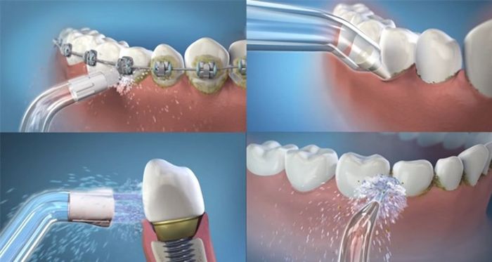 Sử dụng máy tăm nước