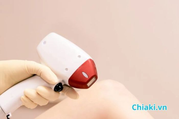 Công nghệ triệt lông IPL