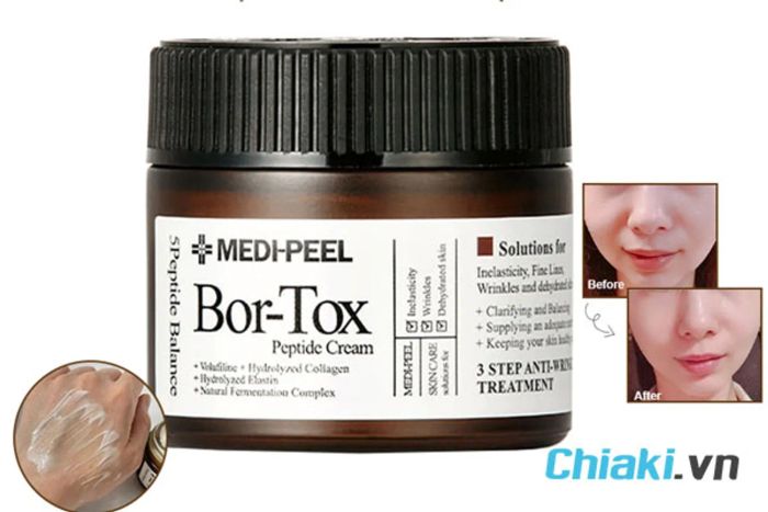 Kem nâng cơ mặt Bor-Tox Peptide của Medi-Peel từ Pháp