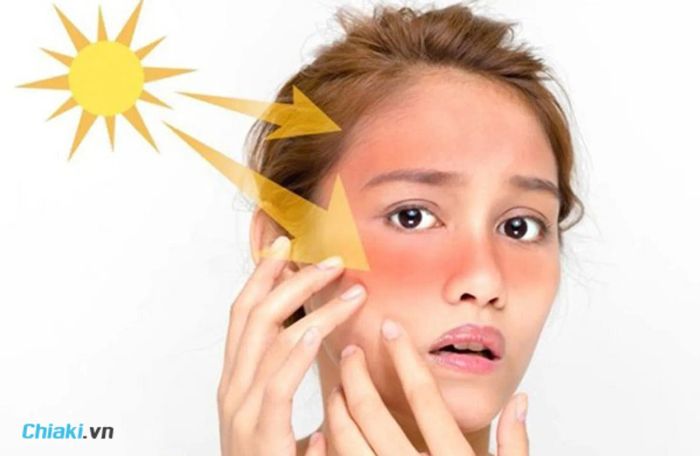 Cách làm trắng da mặt sau khi bị cháy nắng: 8 phương pháp hiệu quả
