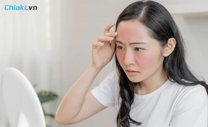 Cách làm trắng da mặt sau khi bị cháy nắng: 8 phương pháp hiệu quả