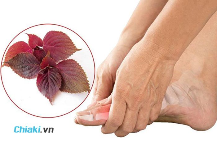 Bí Quyết Sức Khỏe: Bột Lá Tía Tô - Hỗ Trợ Điều Trị Bệnh Gout