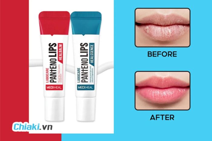 Son Dưỡng Làm Hồng Môi Labocare Panteno Lips Hàn Quốc