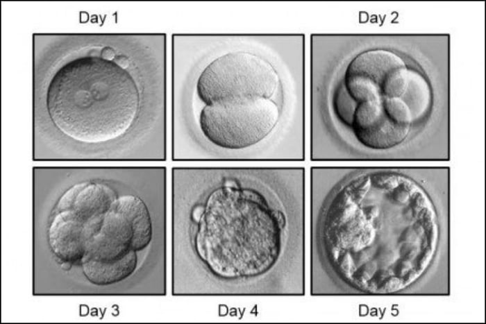 Phôi thai được coi là sự sống bắt đầu trong quá trình phát triển thai nhi