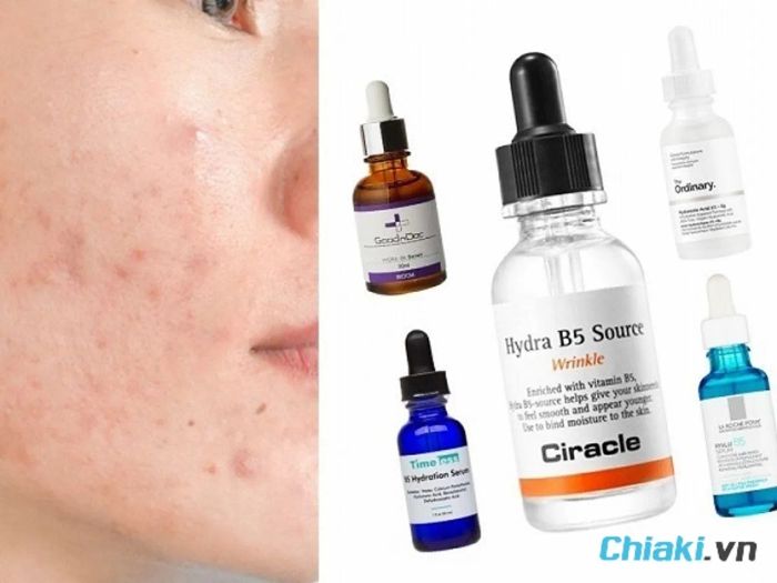 Hydra B5 Serum có những lợi ích gì cho da?