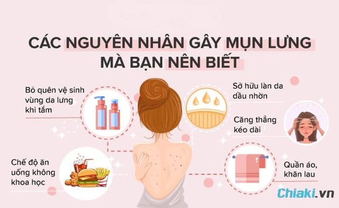 Nguyên nhân gây ra mụn lưng