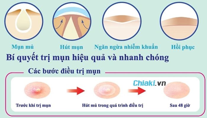 Sử dụng miếng dán mụn có hiệu quả không?