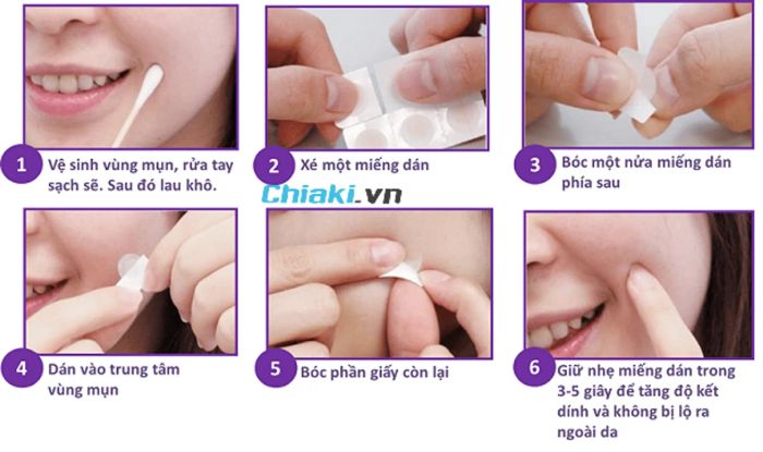 Hướng dẫn sử dụng miếng dán mụn đúng cách