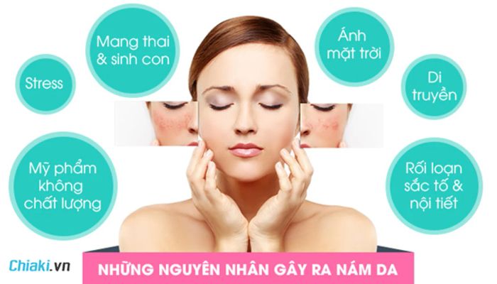 Nguyên nhân gây ra tình trạng nám, tàn nhang ở phụ nữ