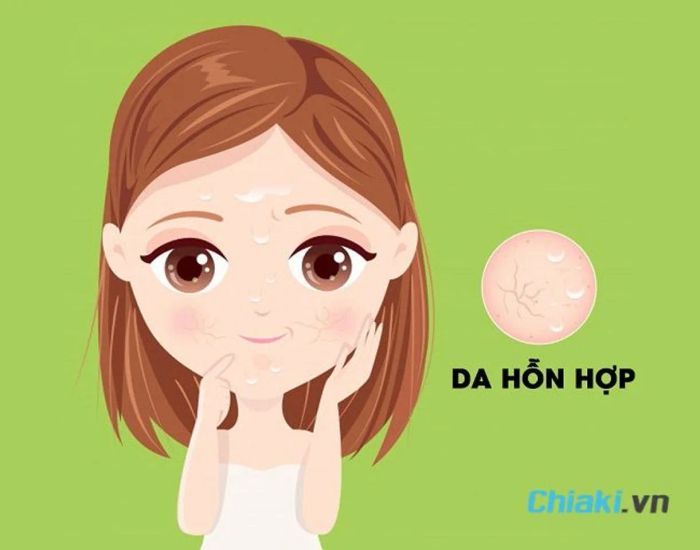 Khái niệm da hỗn hợp là gì?