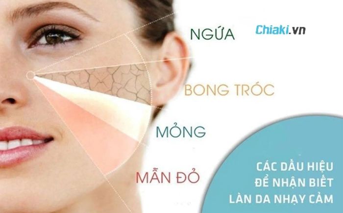 Da dầu mụn nhạy cảm là gì? Có nên sử dụng toner cho da nhạy cảm không?