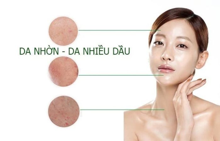 Panthenol trong mỹ phẩm phù hợp cho da nhờn và da dầu mụn.