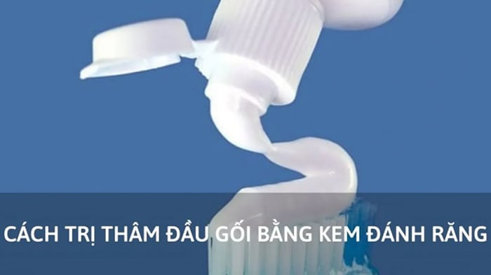 Cách xử lý vết thâm đầu gối bằng kem đánh răng