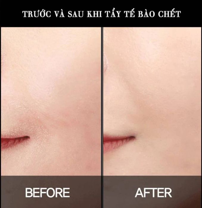 Tác dụng của sữa rửa mặt tẩy tế bào chết là giúp da mịn và giảm sự đổi màu