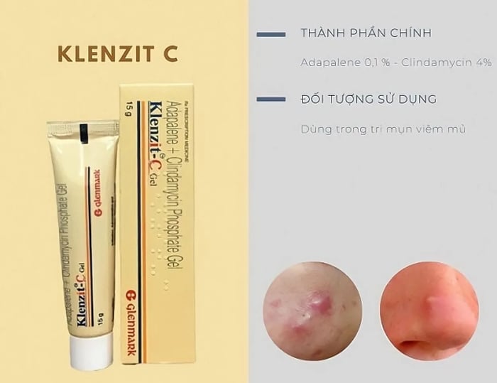 Klenzit C có trị mụn ẩn không