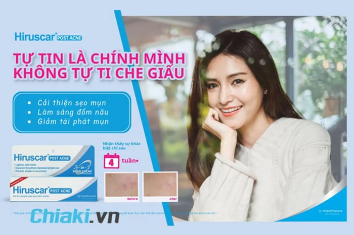 Kem chữa sẹo rỗ se khít lỗ chân lông Hiruscar Post Acne