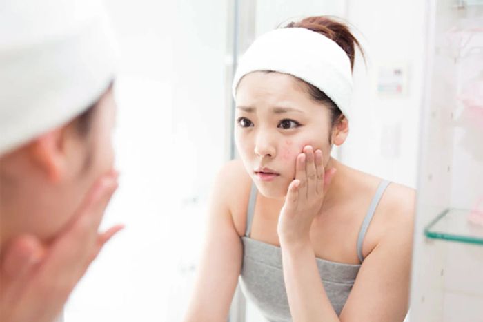 Tác dụng phụ của Collagen có thể làm da nổi mụn