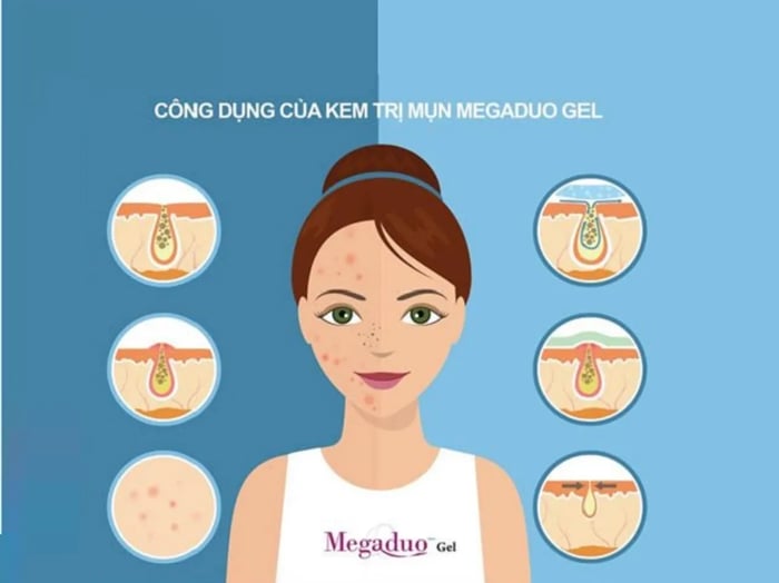 Megaduo trị mụn như thế nào?