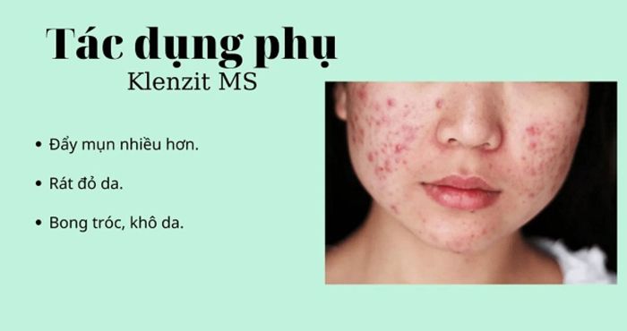 Tác dụng phụ của Klenzit MS