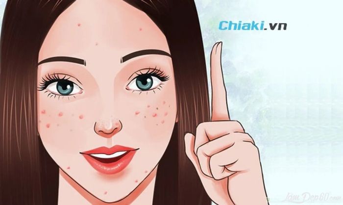 Hướng dẫn lựa chọn kem chống nắng cho da khô mụn