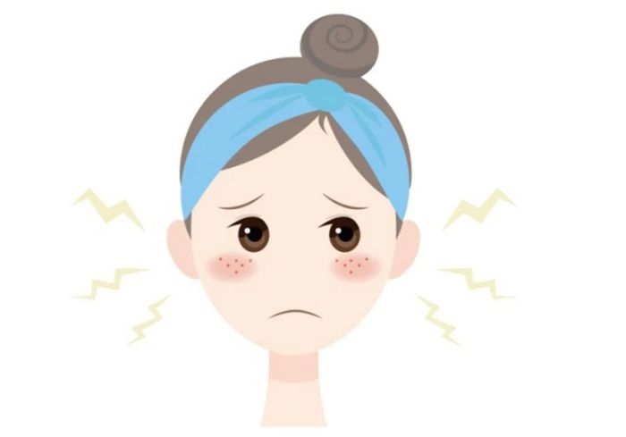 AHA hỗ trợ trong việc điều trị mụn trứng cá