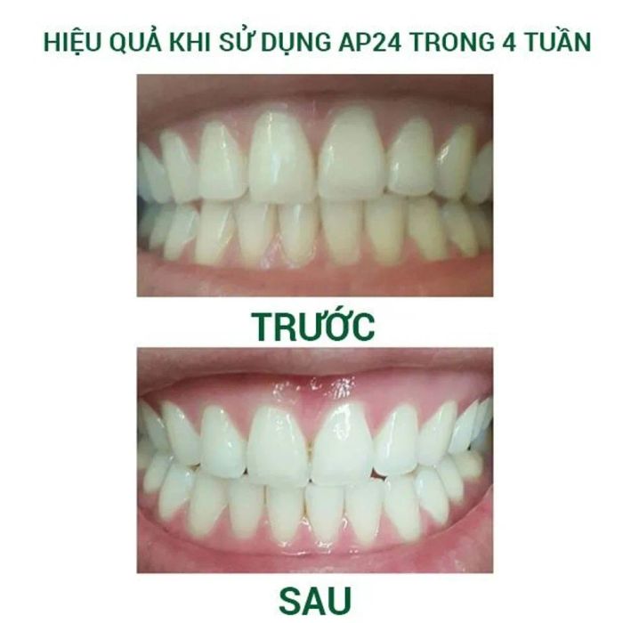 Cách làm trắng răng của kem đánh răng AP24