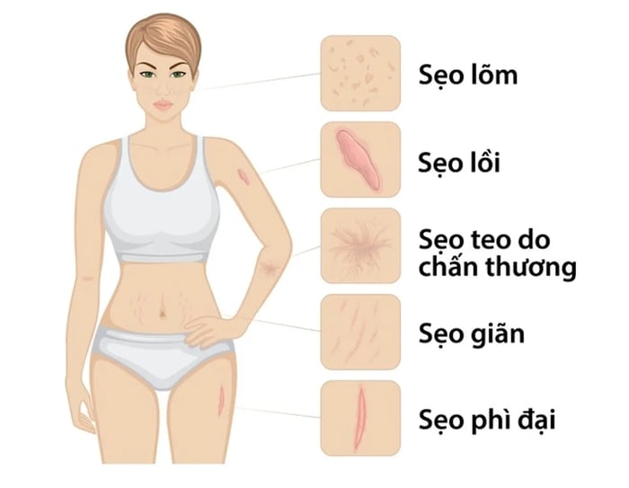 Các loại vết thương