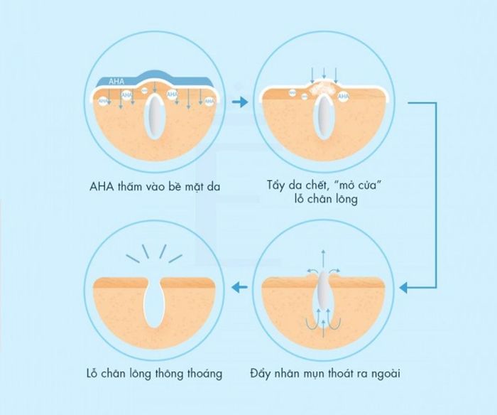 Các loại liệu pháp - AHA