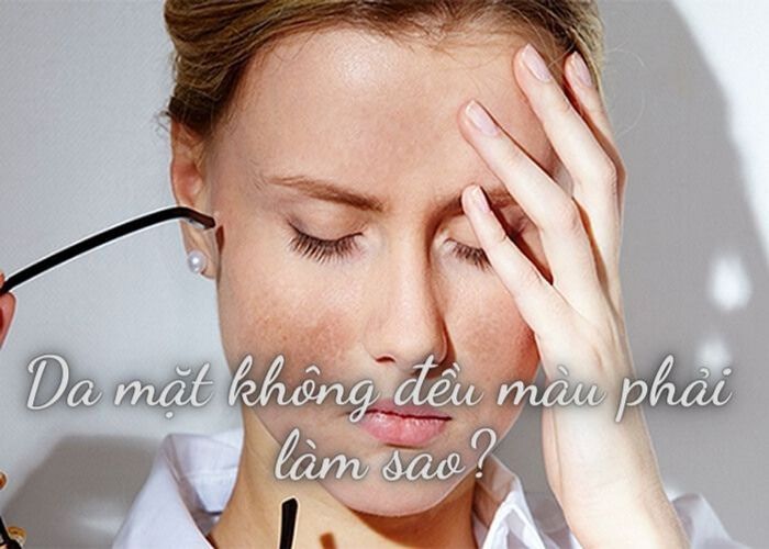 12 cách khắc phục da không đều màu tại nhà một cách đơn giản