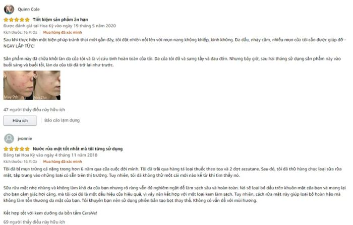 Đánh giá Sữa rửa mặt cho da dầu và lỗ chân lông to CeraVe từ người dùng
