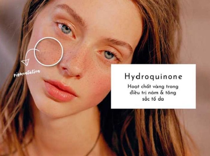 Loại liệu pháp - Hydroquinone