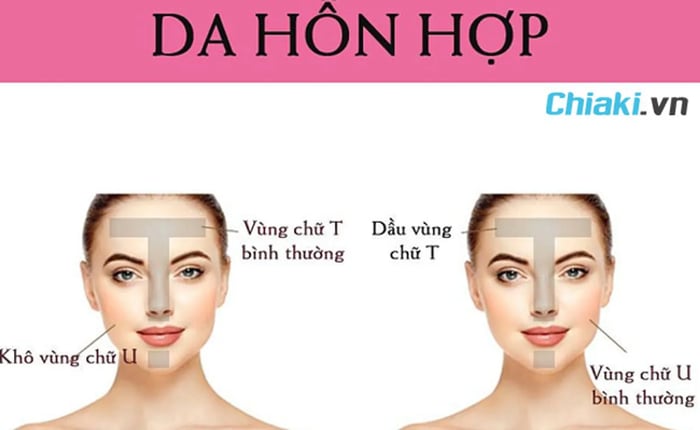 Da hỗn hợp sẽ phân chia từng vùng da khô- dầu lẫn nhau