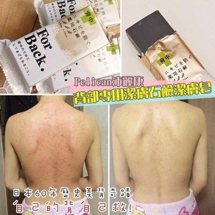 [TIPS] Một số cách giúp loại bỏ mụn lưng từ vài tháng đến vài tuần!