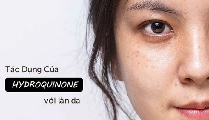 Hydroquinone có công dụng gì?