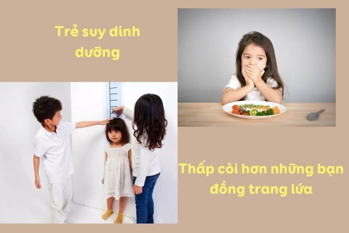 trẻ mắc tình trạng suy dinh dưỡng thể thấp còi