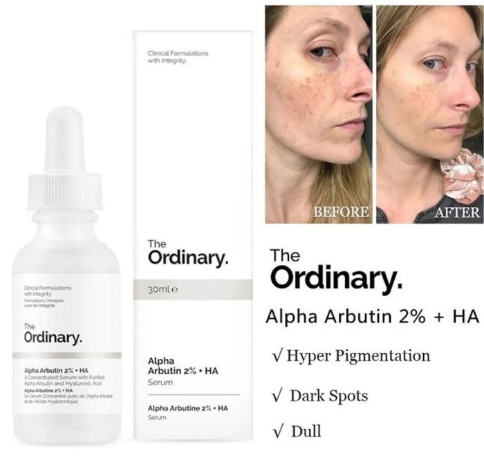 Công dụng của Serum The Ordinary Alpha Arbutin 2% + HA