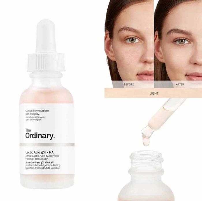 Công dụng của Serum The Ordinary Lactic Acid 5% + HA