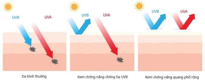 Kem chống nắng phổ rộng cho da dầu mụn