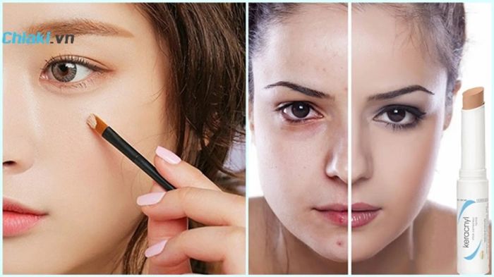 Cách thức sử dụng kem che khuyết điểm cho vùng thâm mụn