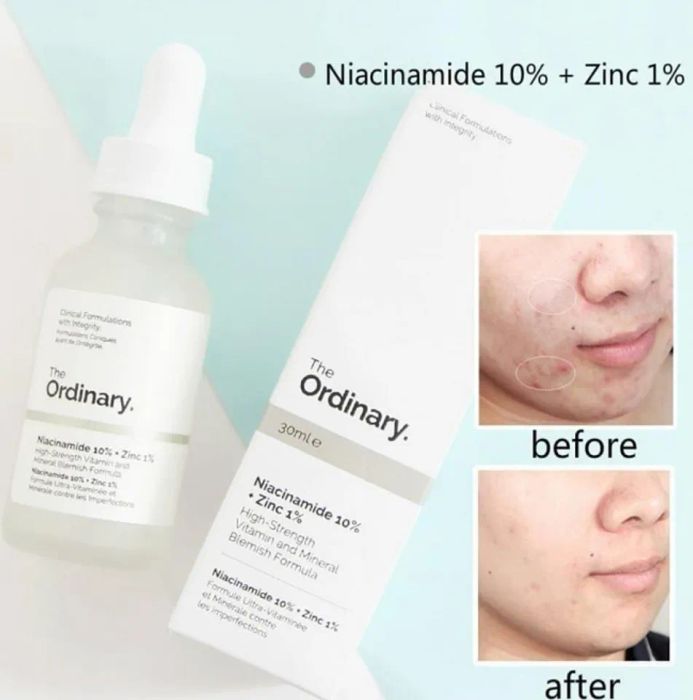 Công dụng của Serum The Ordinary Niacinamide 10% + Zinc 1%