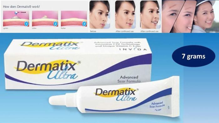 Kem trị sẹo Dermatix Ultra chính hãng