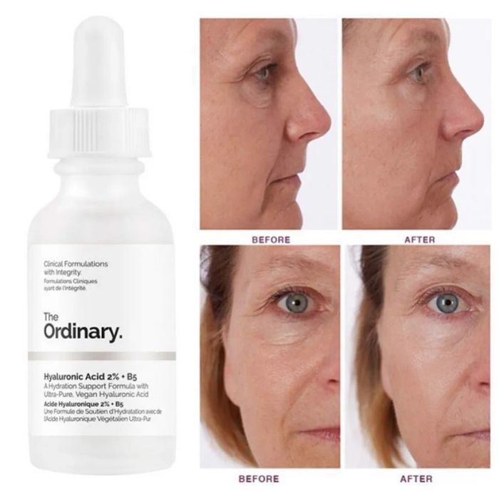 Top 10 Serum The Ordinary tốt nhất hiện nay 2024