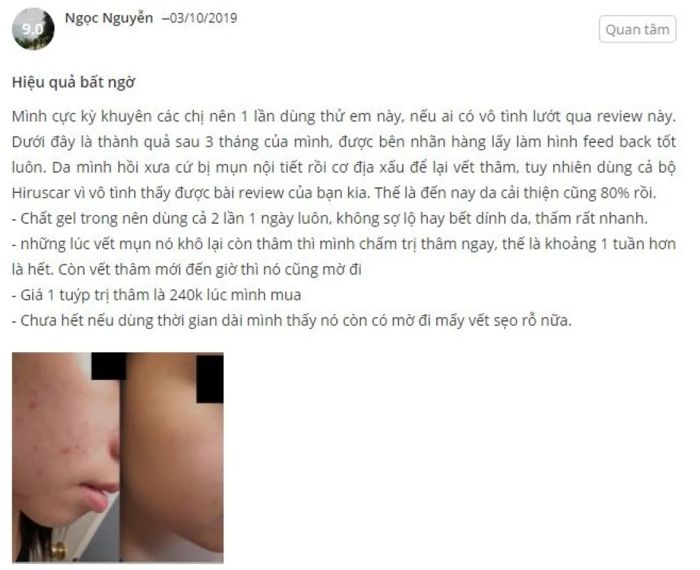 Đánh giá Hiruscar Post Acne sau khi trải nghiệm sản phẩm