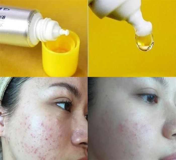 Đánh giá về Serum CC Melano