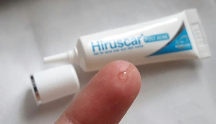 Đánh giá kem trị thâm do mụn Hiruscar Post Acne