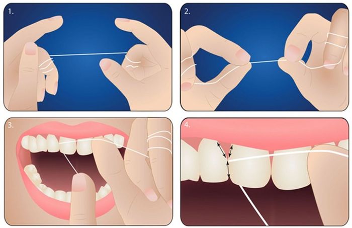 Bước 2: Quấn chỉ nha khoa quanh ngón tay và hướng nó vào kẽ răng.