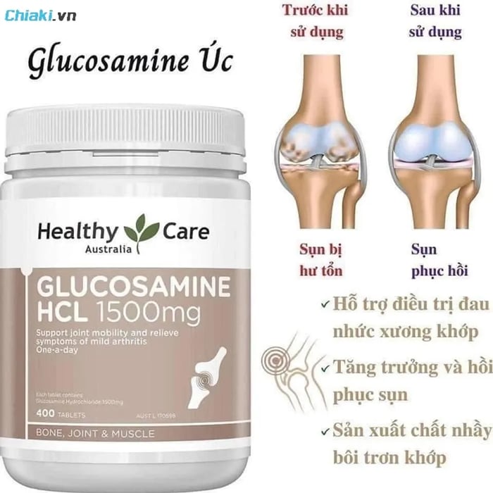 Viên uống Glucosamine HCL 1500mg của Úc