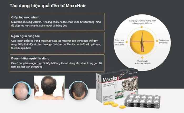 Công dụng chính của Maxxhair mà bạn nên biết