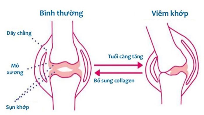 Collagen hỗ trợ bảo vệ xương và giúp khớp vận động trơn tru.