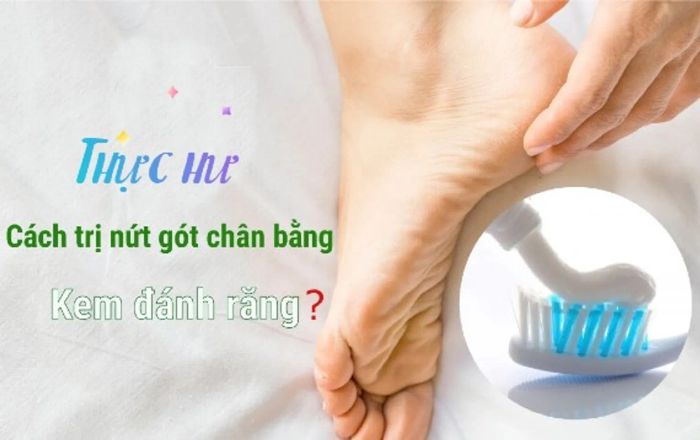 Cách trị nứt gót chân bằng kem đánh răng có tác dụng không?